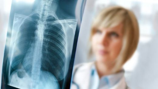 Akciğer Enfeksiyonu Bitkisel Tedavi Yöntemleri