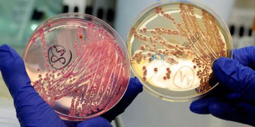 Bağırsak Enfeksiyonu İlaçları Özellikleri ve Faydaları Nelerdir?