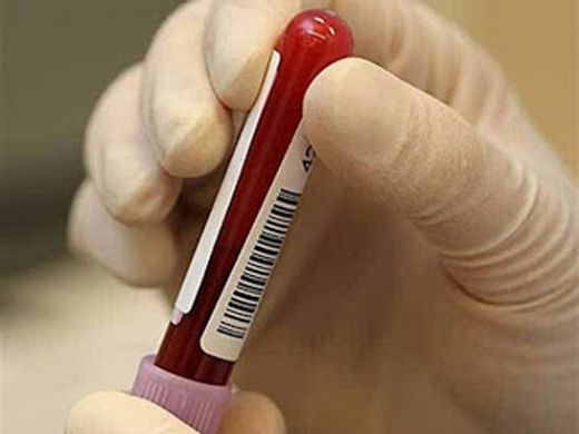 Kanda Enfeksiyon Belirtileri ve Tedavisi